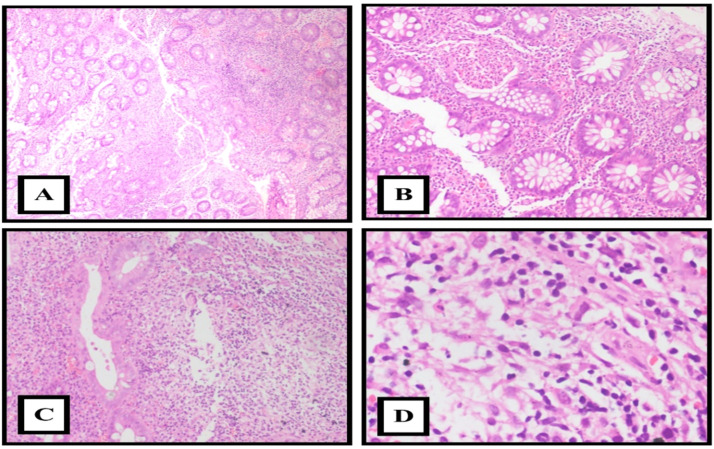 Fig 2: