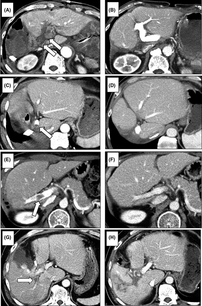 FIGURE 2