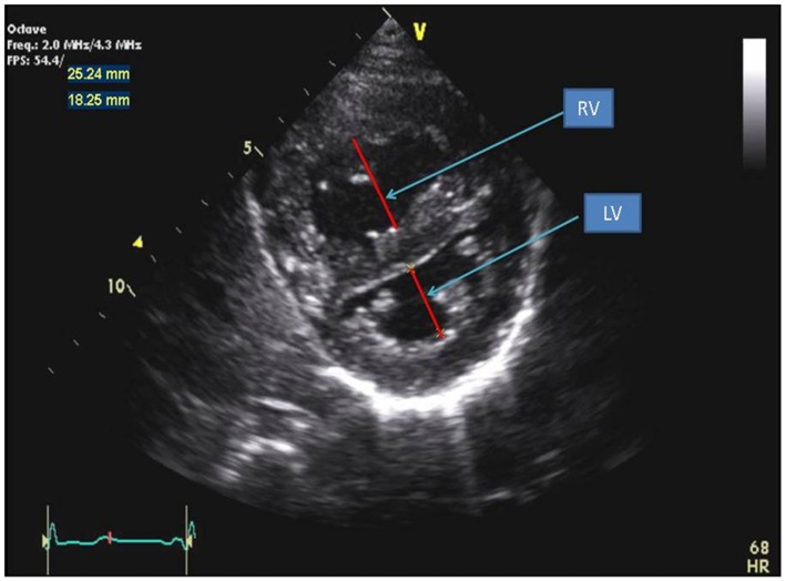 Figure 4