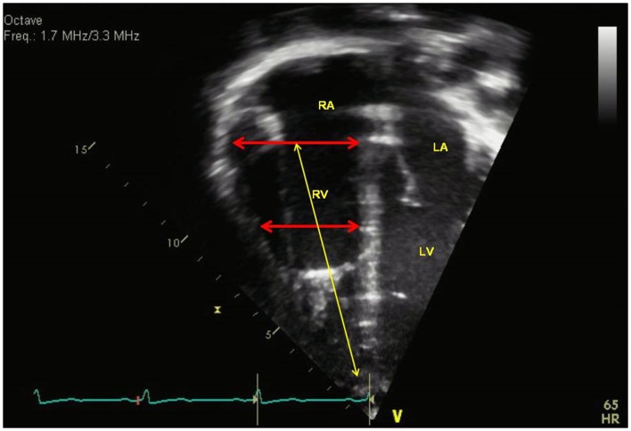 Figure 2