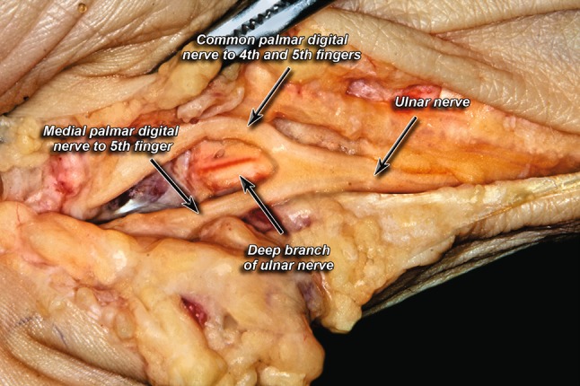 Fig. 2