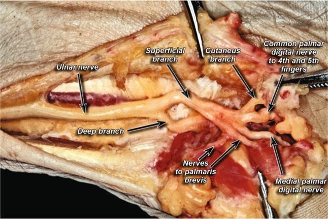 Fig. 1