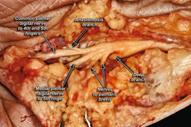 Fig. 6