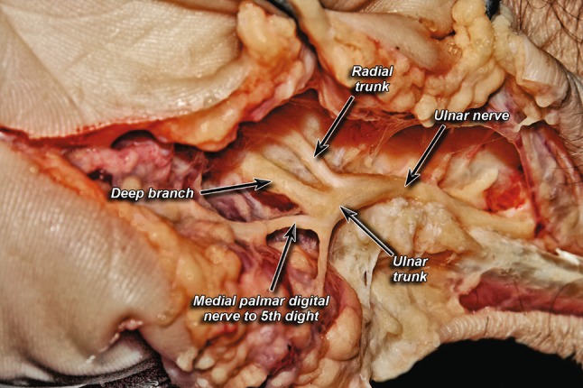 Fig. 3