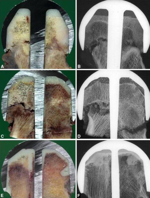 Fig. 3A–F