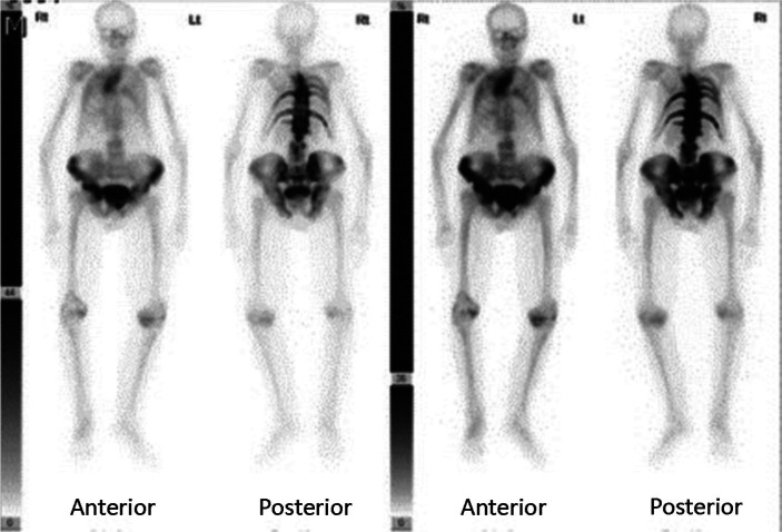 Fig 2.