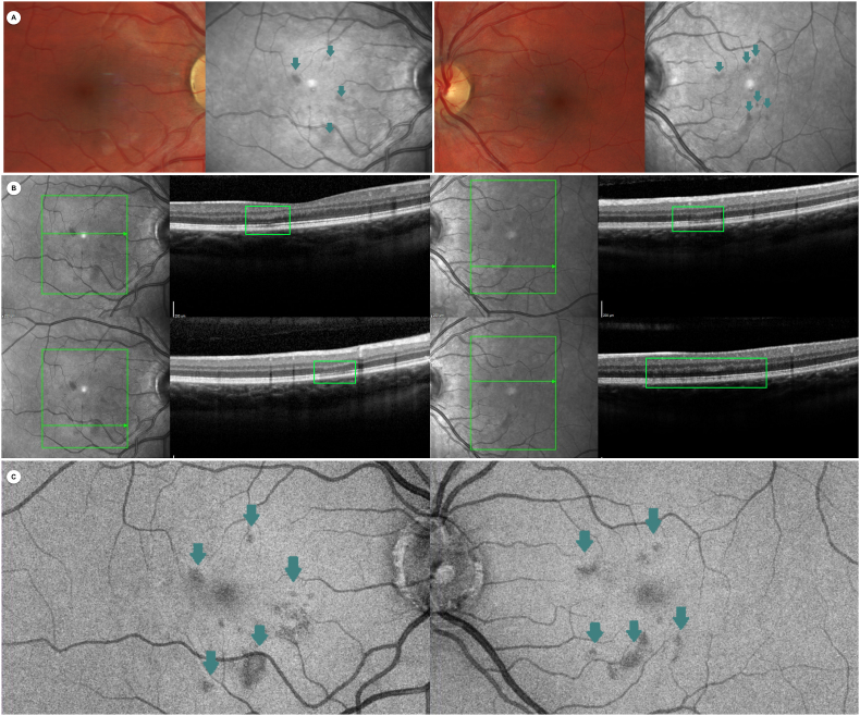 Fig. 1