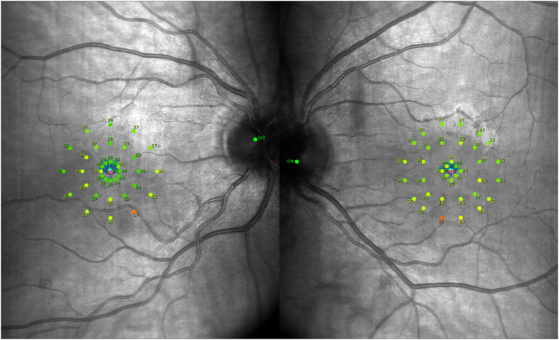 Fig. 2