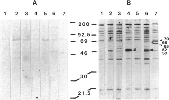 graphic file with name pnas00283-0343-a.jpg