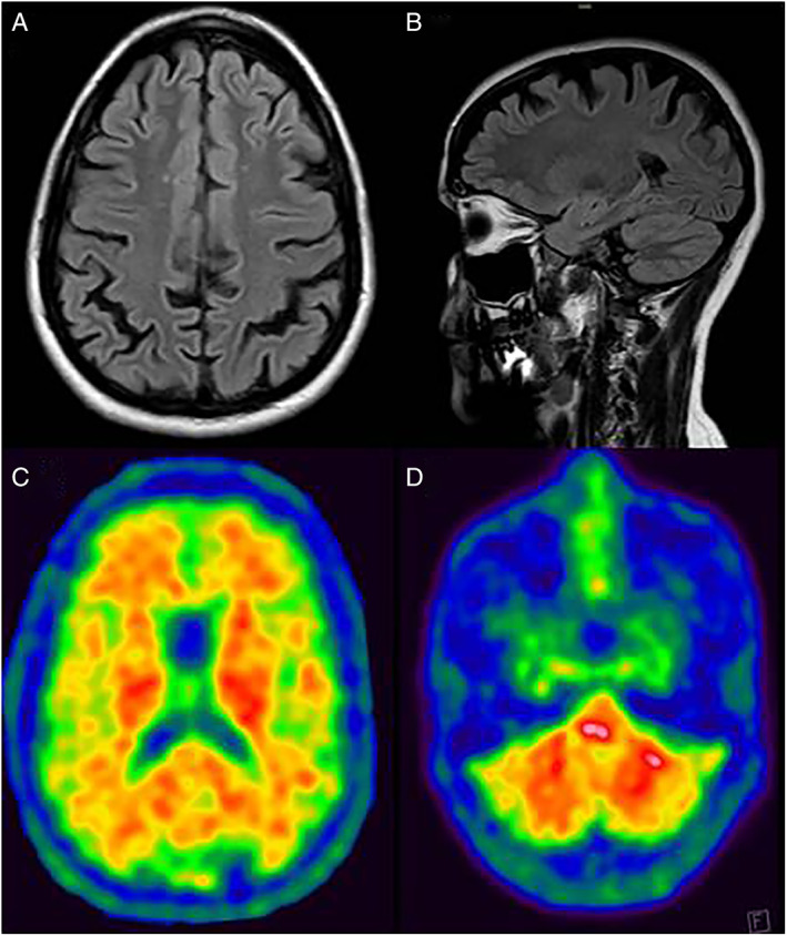 FIG. 1