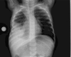 Fig 7.