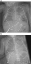 Fig 8.
