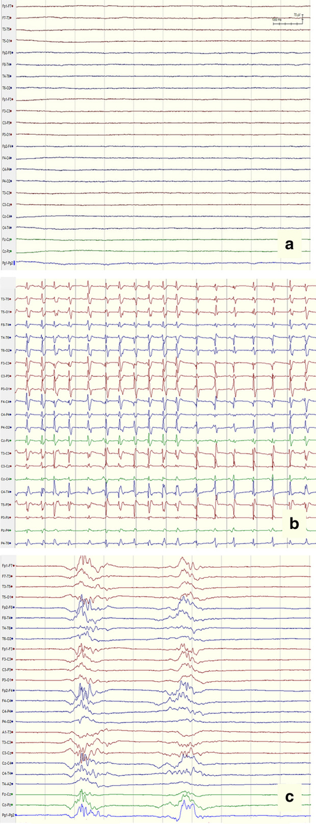 Fig. 6