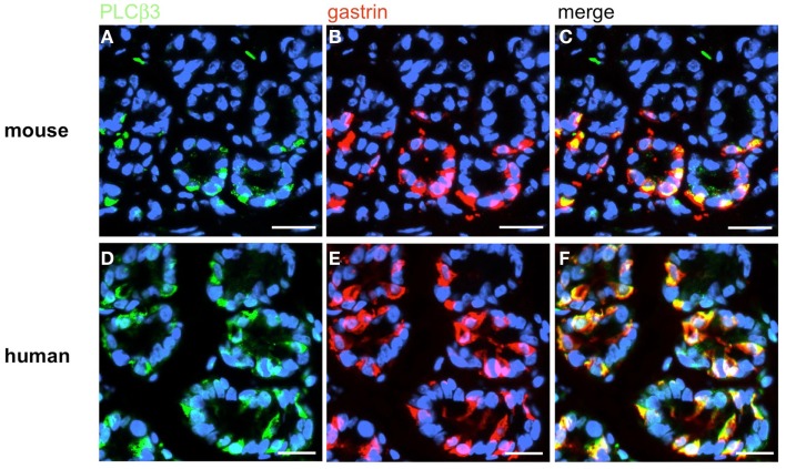 Figure 14