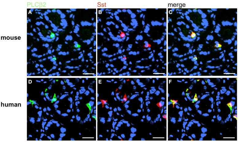 Figure 15