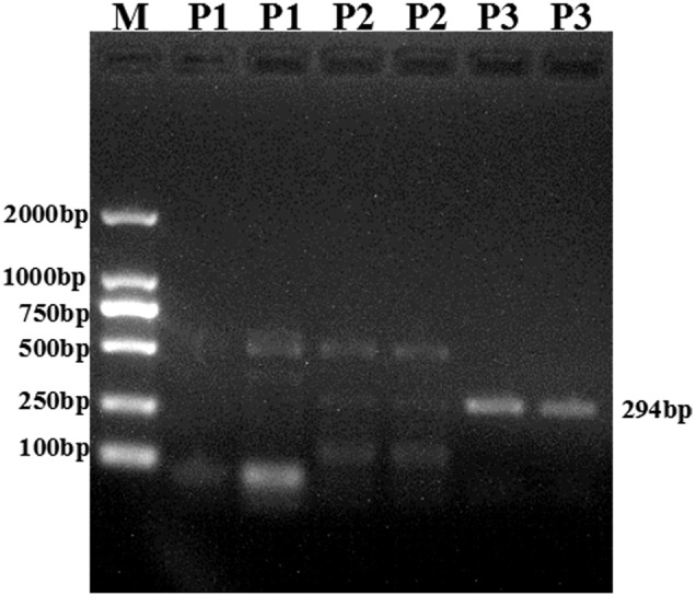 FIGURE 2