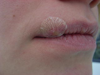graphic file with name 215382_3_Nl_2_Fig3_HTML.jpg