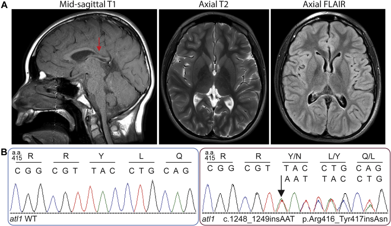 Figure 1