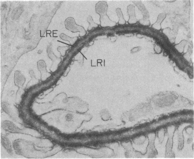 graphic file with name pnas00350-0246-a.jpg