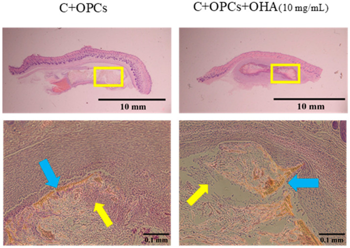 Figure 14