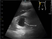 Fig 3.