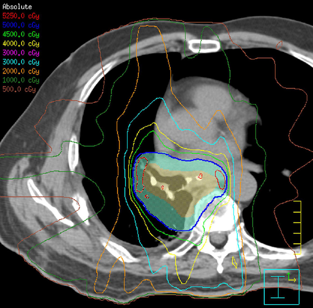 Fig. 12