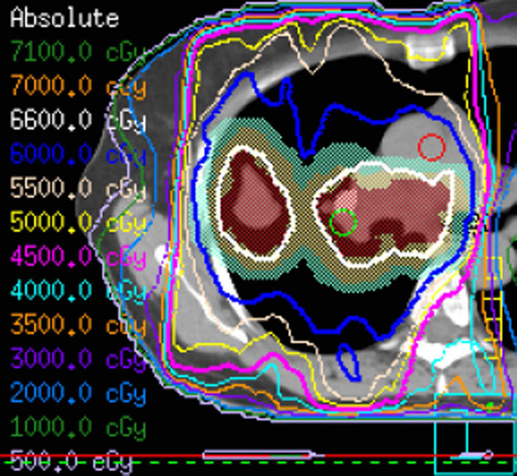 Fig. 13