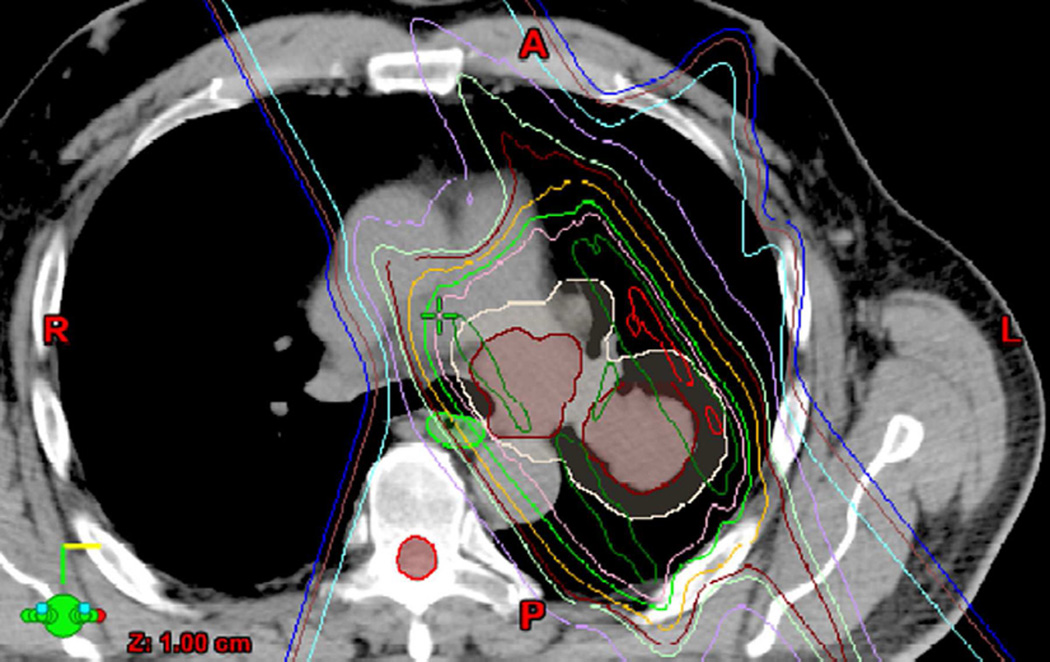 Fig. 4