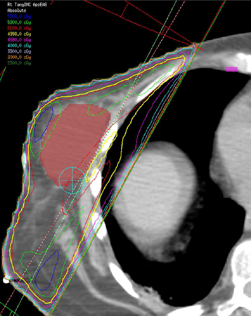 Fig. 11