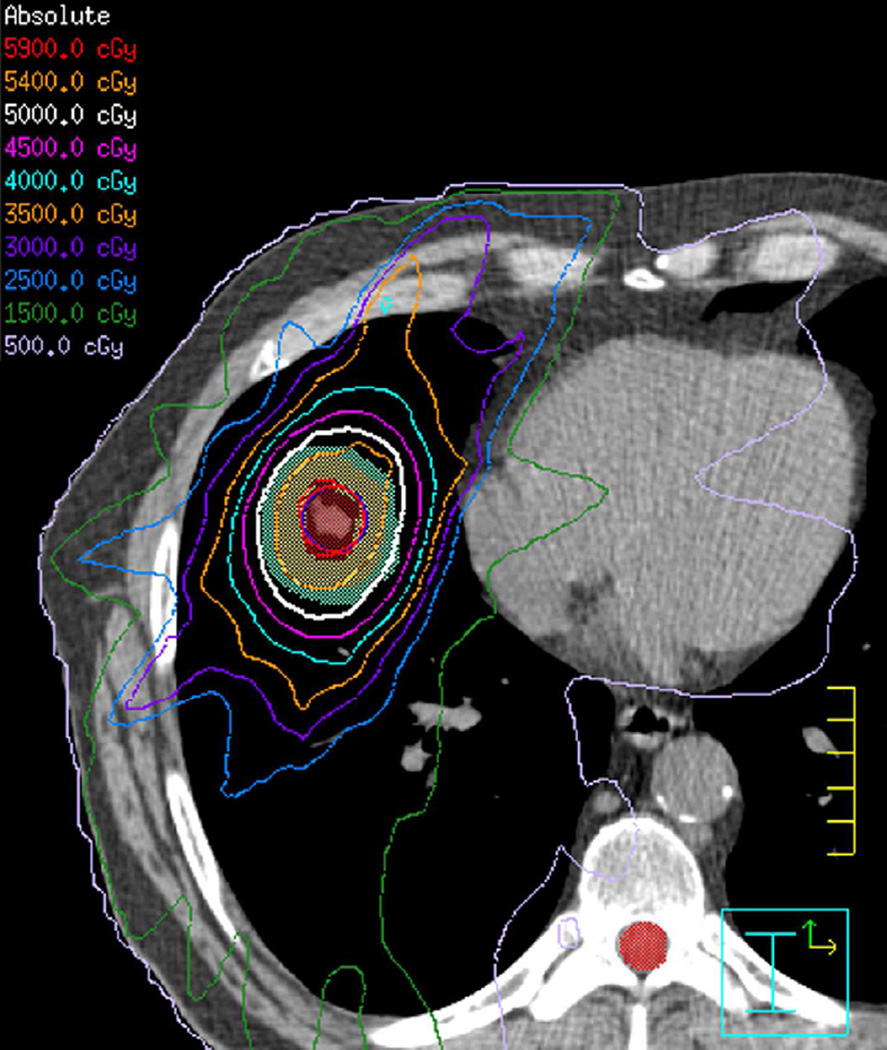 Fig. 14