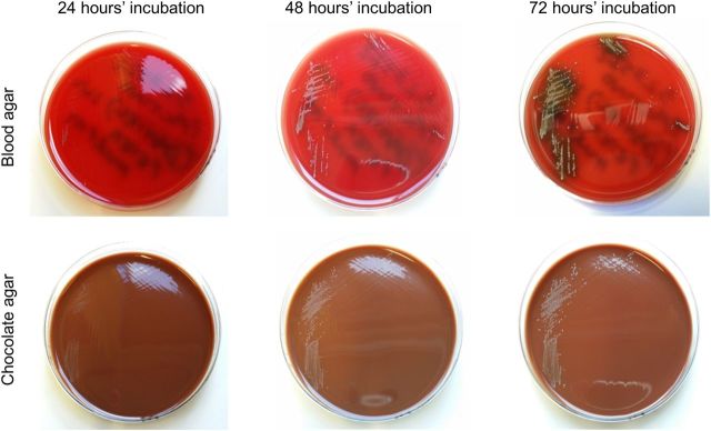 Figure 2: