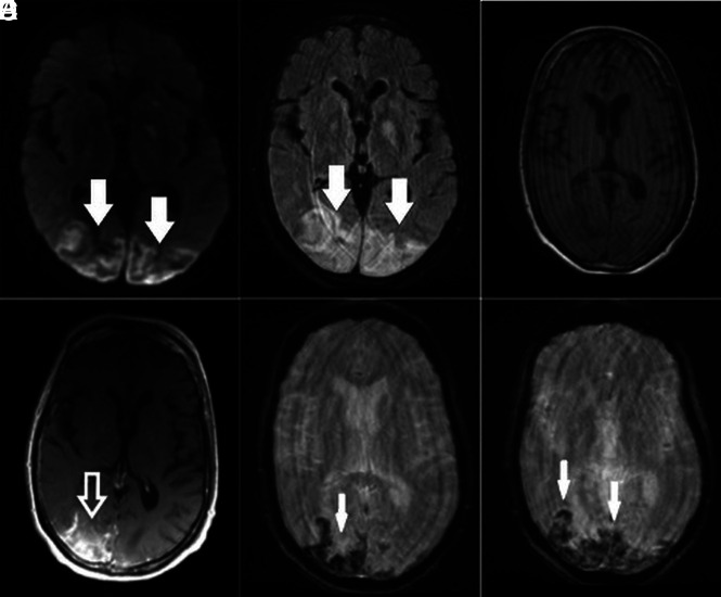 FIG 4.