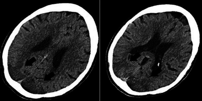 FIG 3.