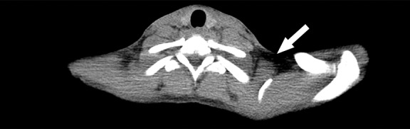 Figure 2a: