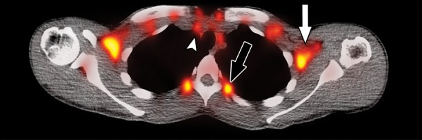 Figure 2d: