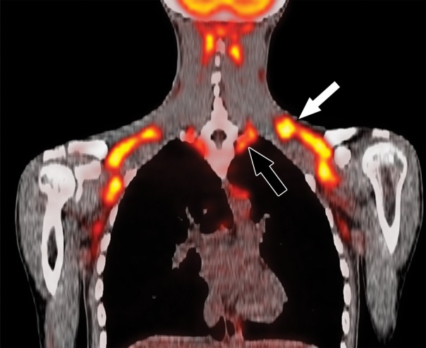 Figure 2f: