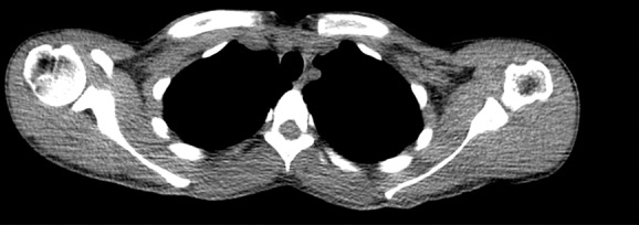 Figure 2c: