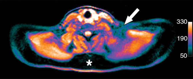 Figure 5e: