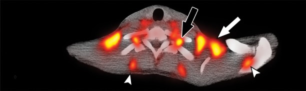 Figure 2b: