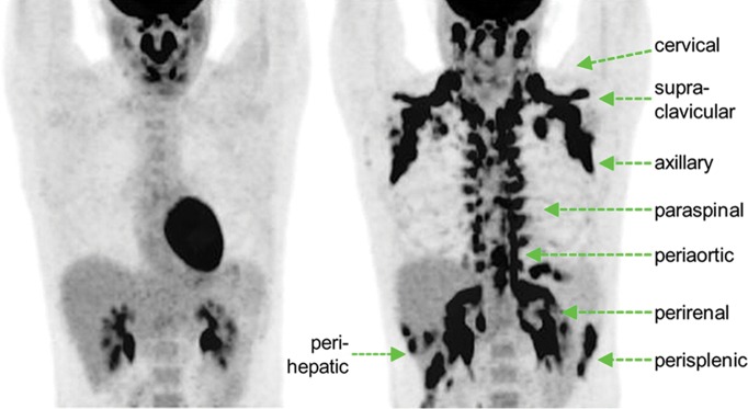 Figure 4a: