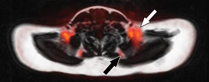 Figure 5d: