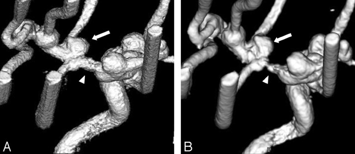 Fig 2.