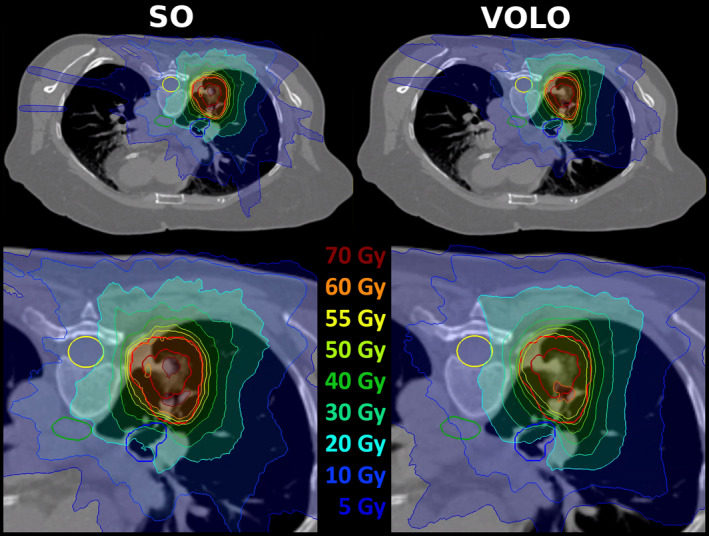 FIG. 8