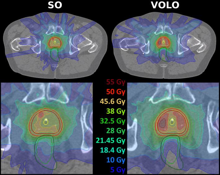 FIG. 4