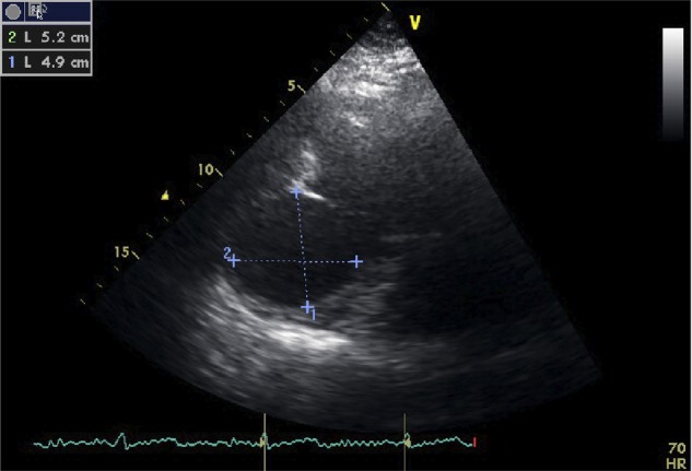 Figure 2