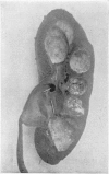 410-1