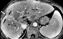 Figure 7c