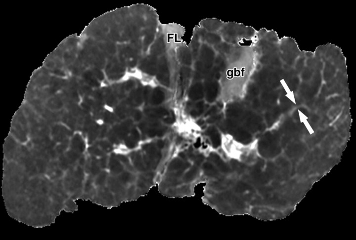 Figure 4b