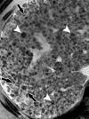 Figure 11d