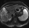 Figure 16b